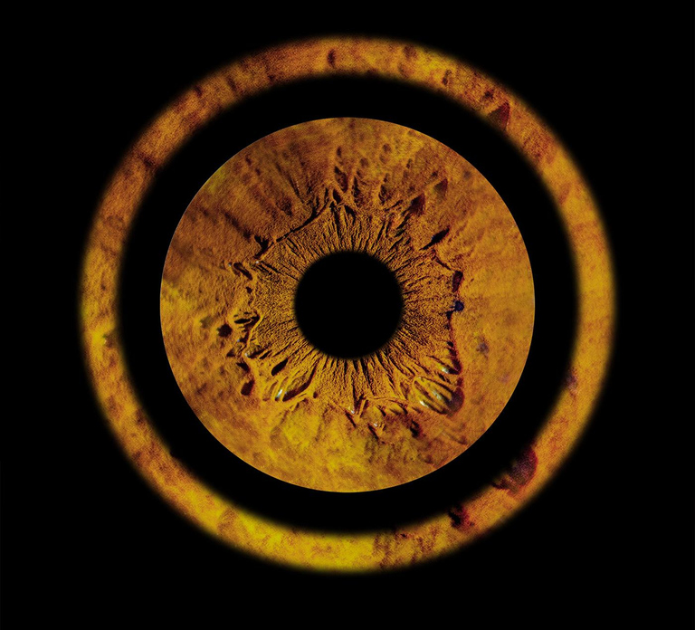 Metz: Your professional iris photography with framed print
